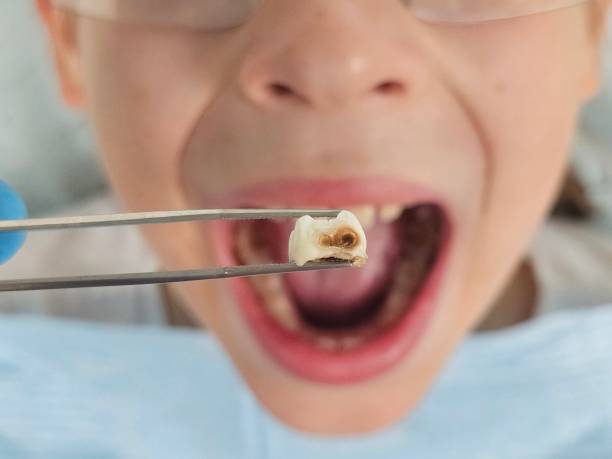 Best Dentist for Tooth Abscess  in Mystic Island, NJ